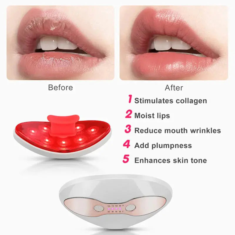 Lip Beauty Device Direct x